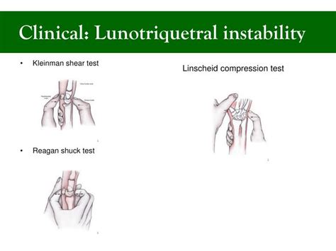 kleinman's shear test results